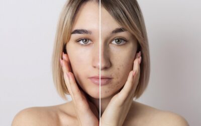 Why Beauty Enthusiasts in Malaysia Should Choose Ultraformer III HIFU Treatment